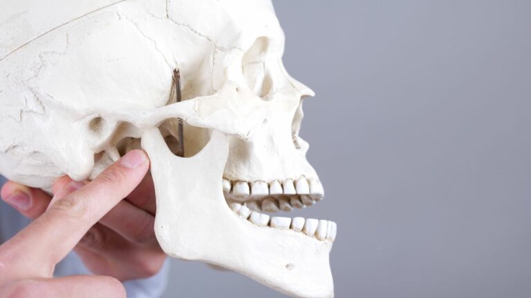 Understanding Temporomandibular Disorders (TMD): A Comprehensive Overview for Healthcare Professionals